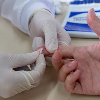 Foto em que paciente realizada coleta de DNA com um profissional de saúde. A imagem mostra apenas a mão direita do paciente, utilizada para coleta, e as mãos do profissional, utilizando luvas para o exame.