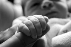 A criança já possui cinco meses de idade e o atraso no tratamento pode trazer sequelas irreparáveis para sua saúde. 